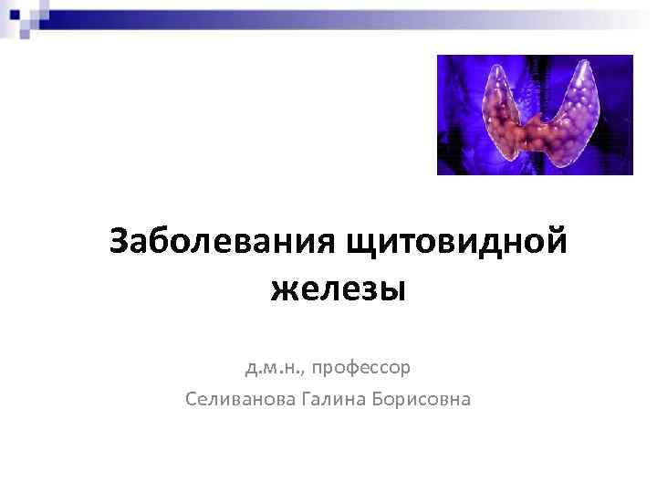 Заболевания щитовидной железы д. м. н. , профессор Селиванова Галина Борисовна 