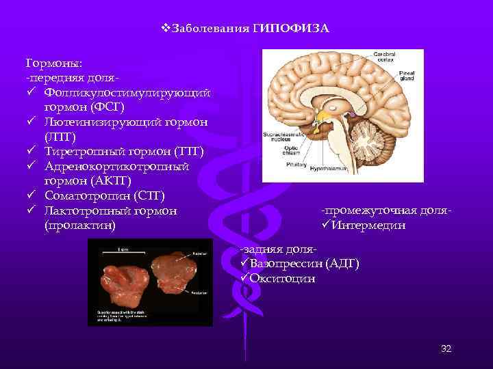 Гипофиз гормоны заболевания