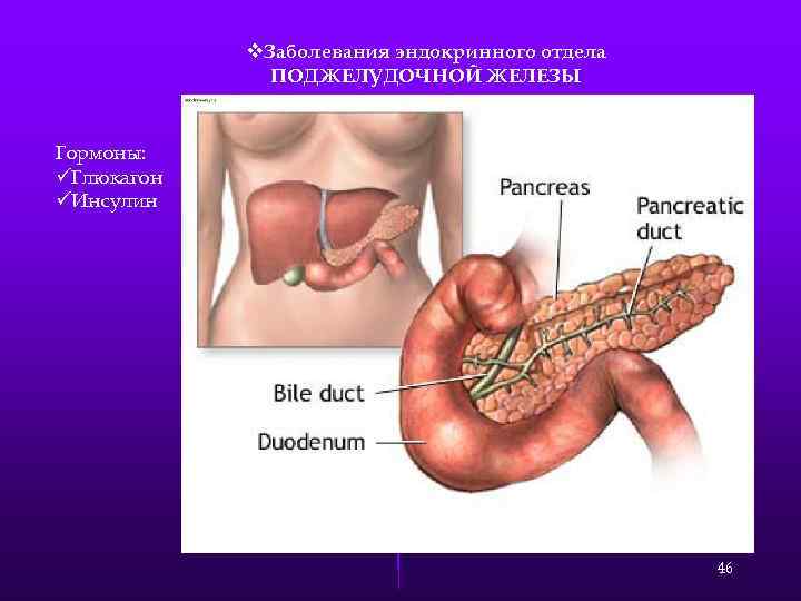 v. Заболевания эндокринного отдела ПОДЖЕЛУДОЧНОЙ ЖЕЛЕЗЫ Гормоны: üГлюкагон üИнсулин 46 