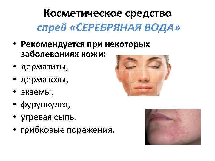 Косметическое средство спрей «СЕРЕБРЯНАЯ ВОДА» • Рекомендуется при некоторых заболеваниях кожи: • дерматиты, •