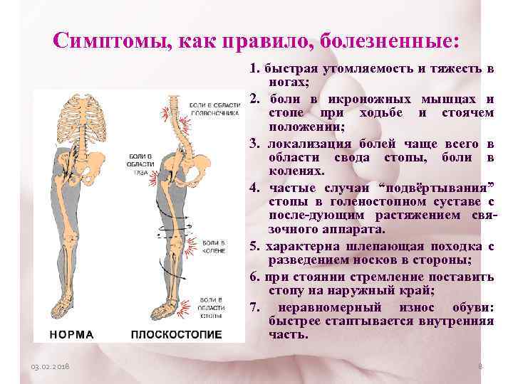 Симптомы, как правило, болезненные: 1. быстрая утомляемость и тяжесть в ногах; 2. боли в