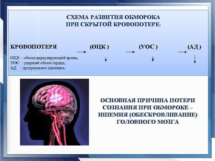 СХЕМА РАЗВИТИЯ ОБМОРОКА ПРИ СКРЫТОЙ КРОВОПОТЕРЕ: КРОВОПОТЕРЯ (ОЦК ) (УОС ) (АД ) ОЦК