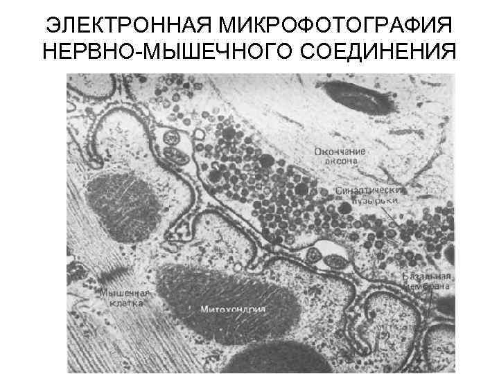 ЭЛЕКТРОННАЯ МИКРОФОТОГРАФИЯ НЕРВНО-МЫШЕЧНОГО СОЕДИНЕНИЯ 