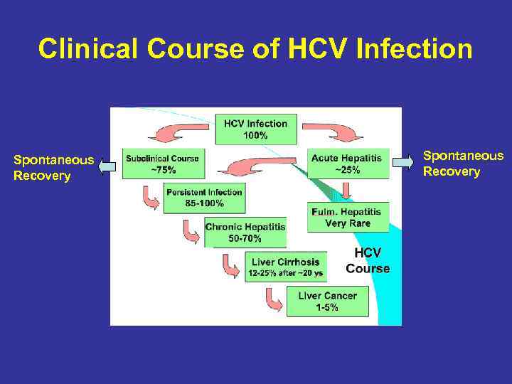 Clinical Course of HCV Infection Spontaneous Recovery 