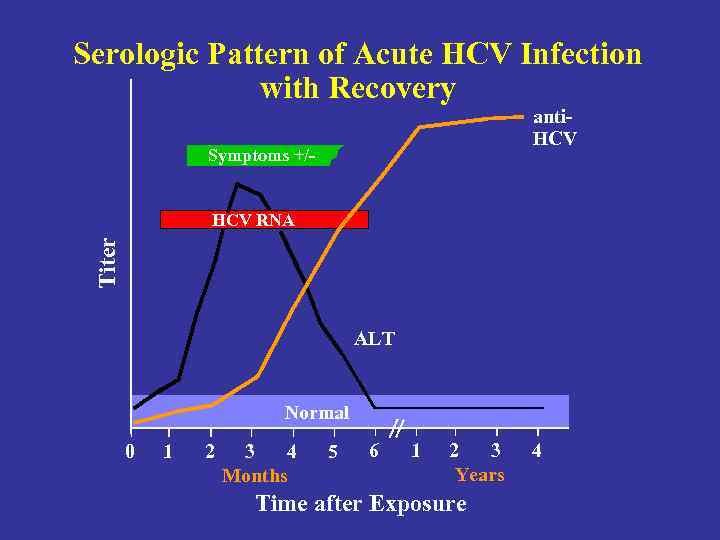 Serologic Pattern of Acute HCV Infection with Recovery anti. HCV Symptoms +/- Titer HCV