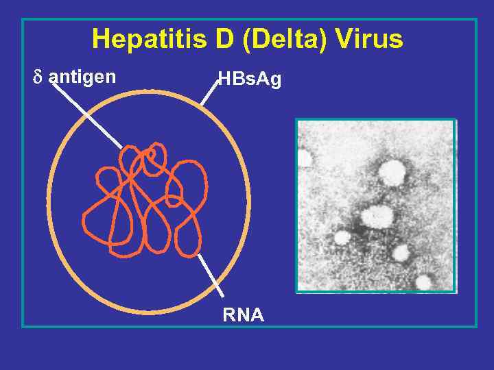 Hepatitis D (Delta) Virus d antigen HBs. Ag RNA 