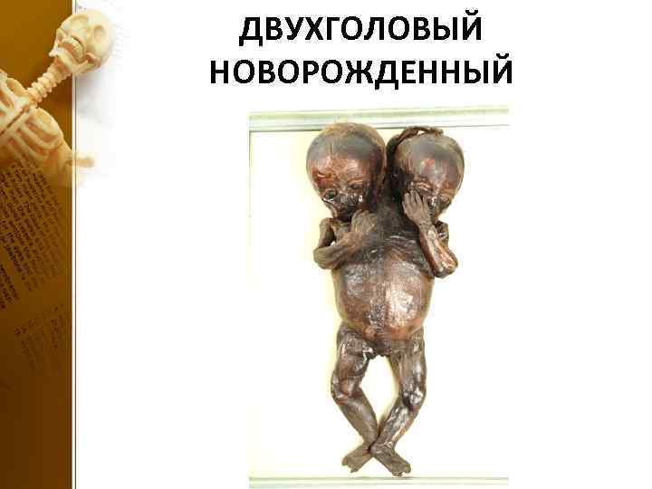 ДВУХГОЛОВЫЙ НОВОРОЖДЕННЫЙ 