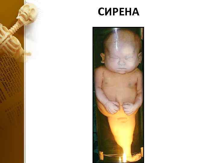 СИРЕНА 