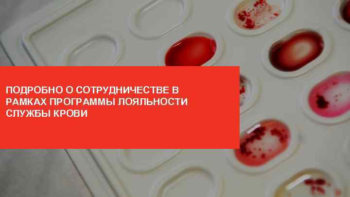 ПОДРОБНО О СОТРУДНИЧЕСТВЕ В РАМКАХ ПРОГРАММЫ ЛОЯЛЬНОСТИ СЛУЖБЫ КРОВИ 