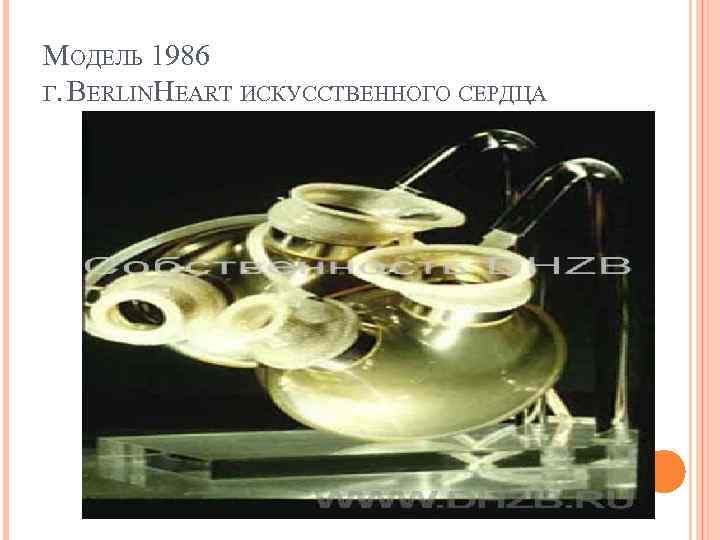 МОДЕЛЬ 1986 Г. BERLINHEART ИСКУССТВЕННОГО СЕРДЦА 