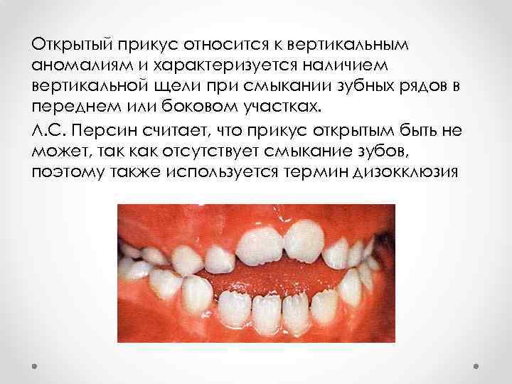 Открытый прикус относится к вертикальным аномалиям и характеризуется наличием вертикальной щели при смыкании зубных