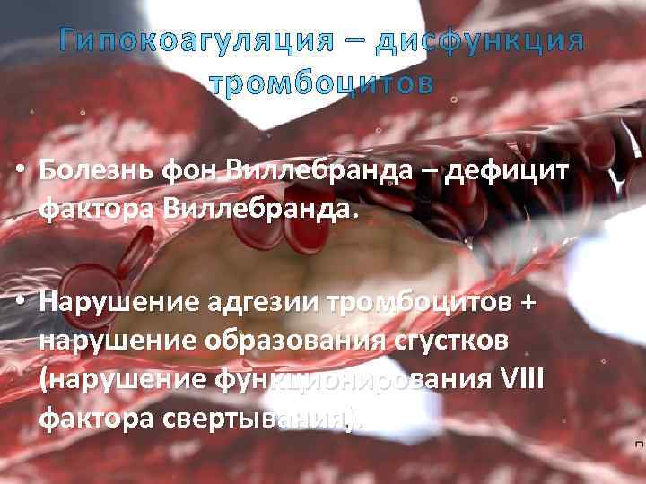 Гипокоагуляция – дисфункция тромбоцитов • Болезнь фон Виллебранда – дефицит фактора Виллебранда. • Нарушение