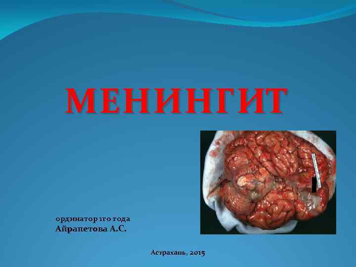 МЕНИНГИТ ординатор 1 го года Айрапетова А. С. Астрахань, 2015 