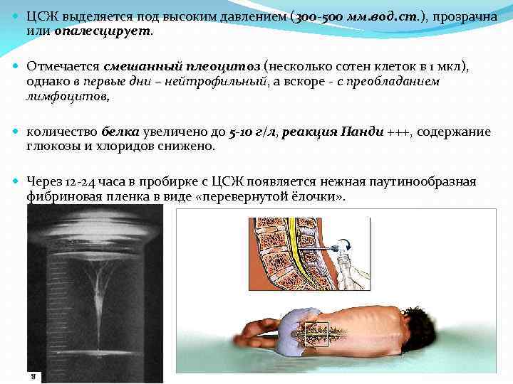  ЦСЖ выделяется под высоким давлением (300 -500 мм. вод. ст. ), прозрачна или