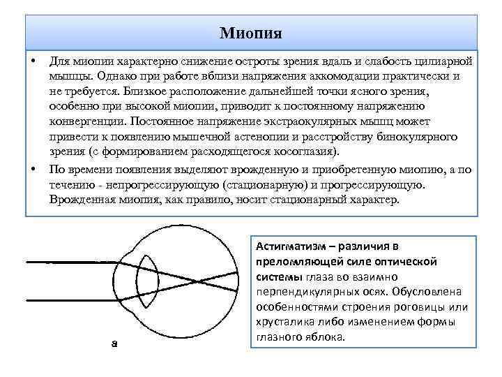 Миопия • • Для миопии характерно снижение остроты зрения вдаль и слабость цилиарной мышцы.
