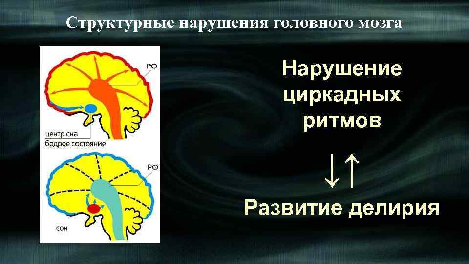 Структурные нарушения головного мозга Нарушение циркадных ритмов ↓↑ Развитие делирия 
