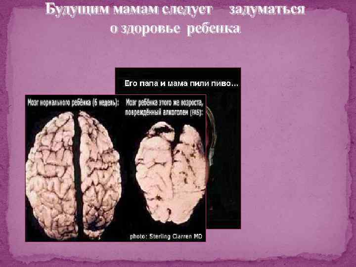 Будущим мамам следует задуматься о здоровье ребенка 