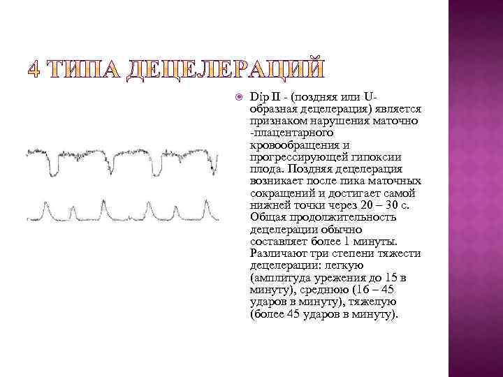  Dip II (поздняя или U образная децелерация) является признаком нарушения маточно плацентарного кровообращения