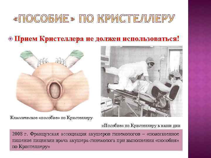  Прием Кристеллера не должен использоваться! Классическое «пособие» по Кристеллеру «Пособие» по Кристеллеру в