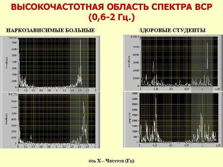 ВЫСОКОЧАСТОТНАЯ ОБЛАСТЬ СПЕКТРА ВСР (0, 6 -2 Гц. ) НАРКОЗАВИСИМЫЕ БОЛЬНЫЕ ось Х –