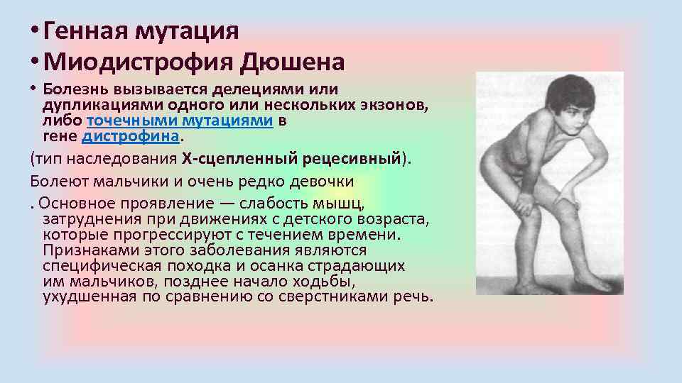  • Генная мутация • Миодистрофия Дюшена • Болезнь вызывается делециями или дупликациями одного