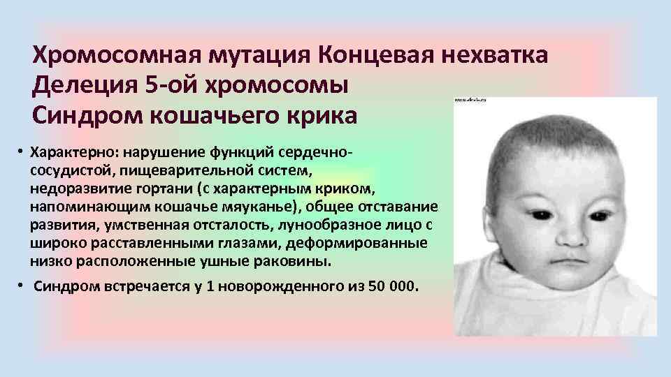 Хромосомная мутация Концевая нехватка Делеция 5 -ой хромосомы Синдром кошачьего крика • Характерно: нарушение