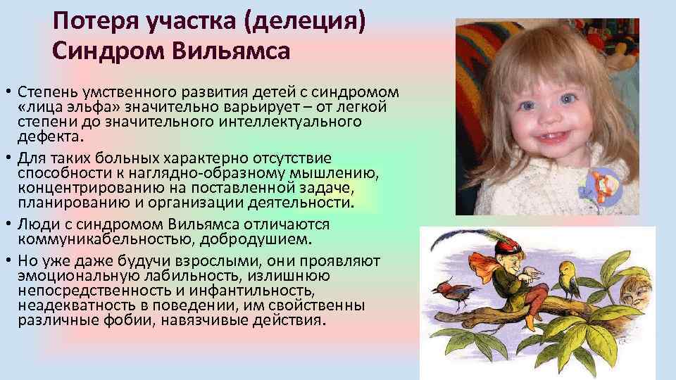 Потеря участка (делеция) Синдром Вильямса • Степень умственного развития детей с синдромом «лица эльфа»