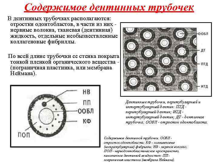 Содержимое дентинных трубочек В дентинных трубочках располагаются: отростки одонтобластов, в части из них -
