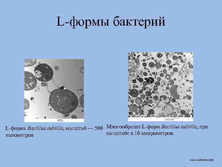 L-формы бактерий L-форма Bacillus subtilis, масштаб — 500 Многообразие L-форм Bacillus subtilis, при масштабе