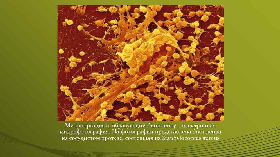 Биопленки кандиды. Биопленки Staphylococcus aureus. Биопленка микроорганизмов. Биопленка золотистого стафилококка.