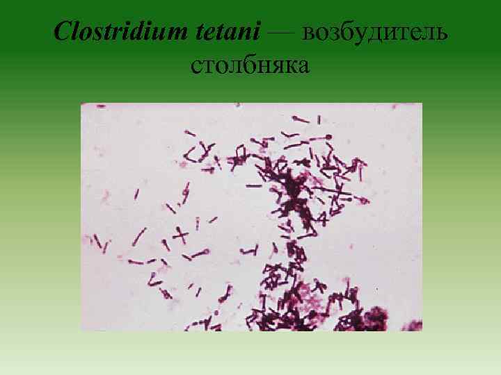 Clostridium tetani — возбудитель столбняка 