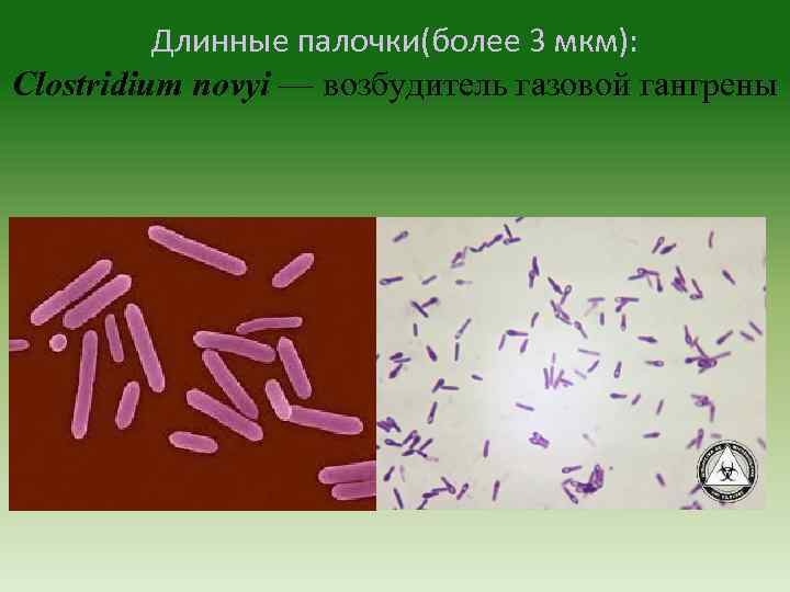 Длинные палочки(более 3 мкм): Clostridium novyi — возбудитель газовой гангрены 