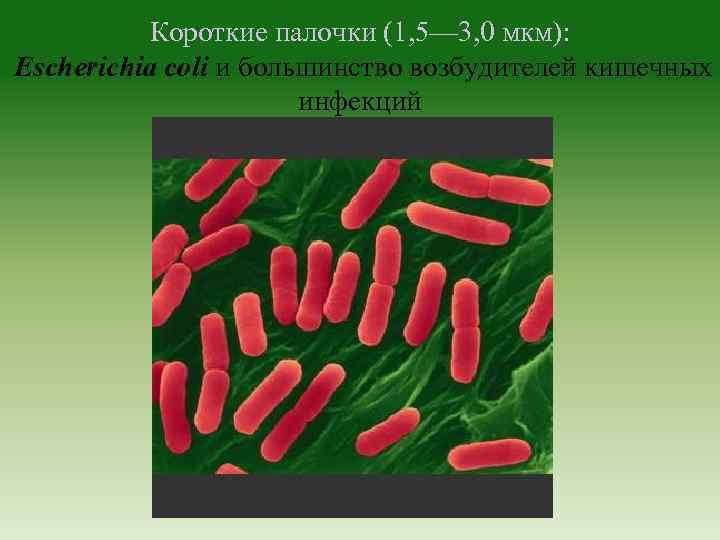Короткие палочки (1, 5— 3, 0 мкм): Escherichia coli и большинство возбудителей кишечных инфекций