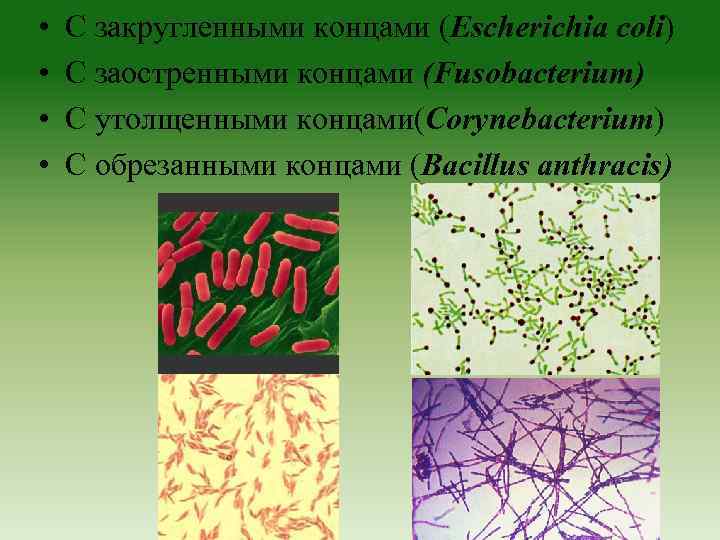  • • С закругленными концами (Escherichia coli) С заостренными концами (Fusobacterium) С утолщенными