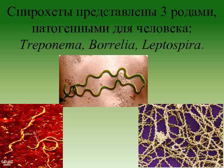 Спирохеты представлены 3 родами, патогенными для человека: Treponema, Borrelia, Leptospira. 