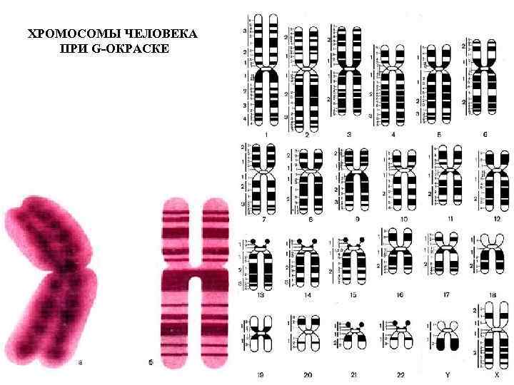 ХРОМОСОМЫ ЧЕЛОВЕКА ПРИ G ОКРАСКЕ 