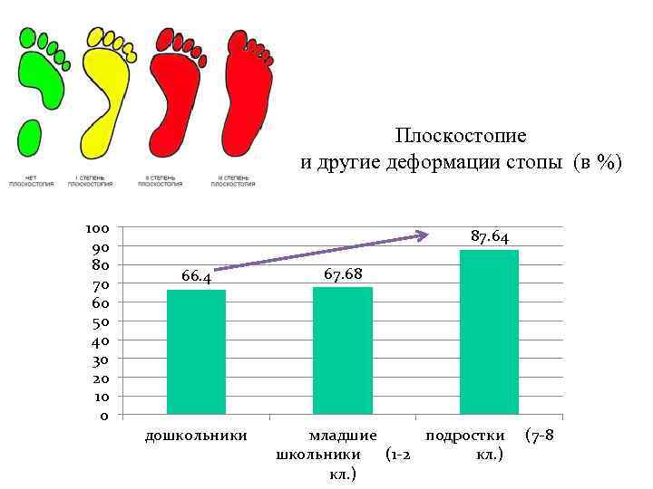 Население 80. Данные воз по плоскостопию у детей. Деформация стопы заболеваемость. Процент населения с плоскостопием. Заболевание у 80% населения.