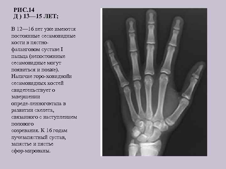 РИС. 14 Д ) 13— 15 ЛЕТ; В 12— 16 лет уже имеются постоянные