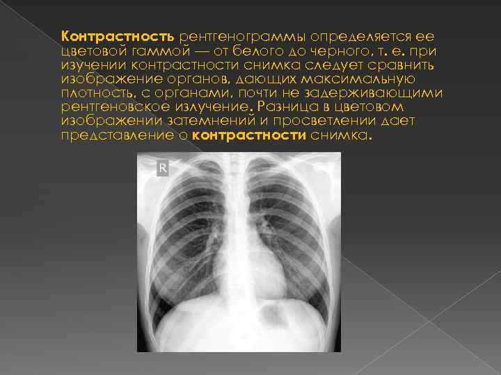 Изображение органов на рентгенограммах является ответ на тест