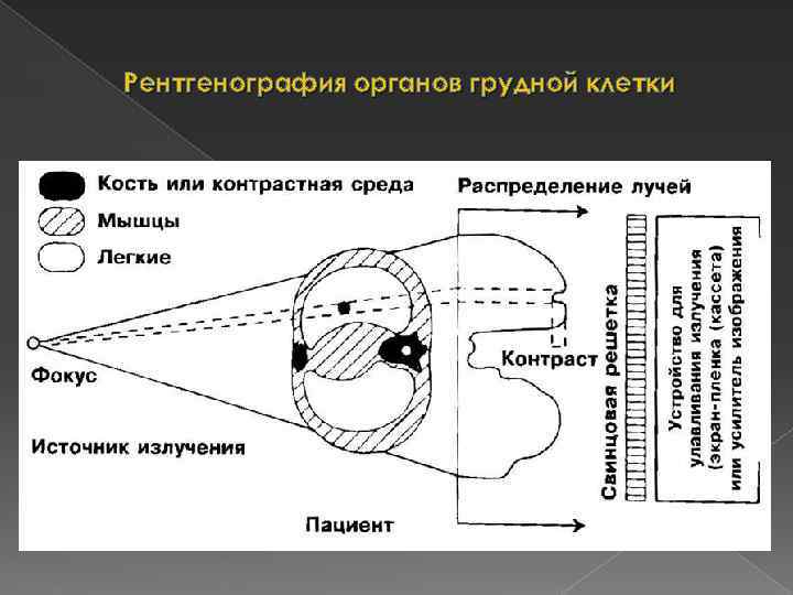 Принципиальный порядок изучения лучевого изображения