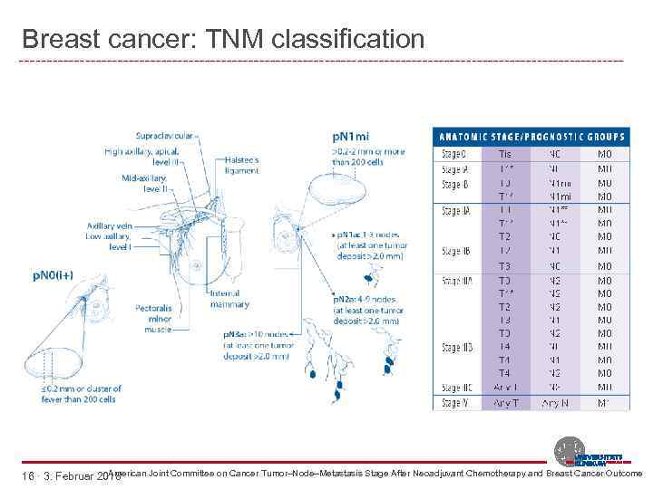 Breast cancer: TNM classification American Joint Committee on Cancer Tumor–Node–Metastasis Stage After Neoadjuvant Chemotherapy