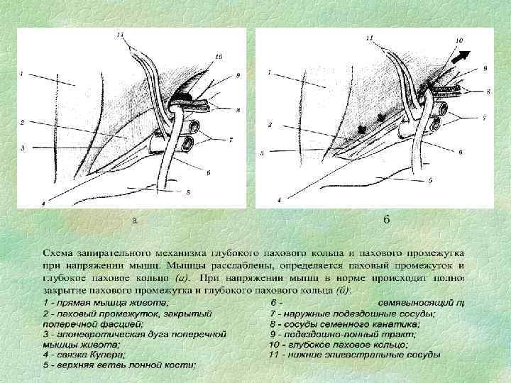 а б 