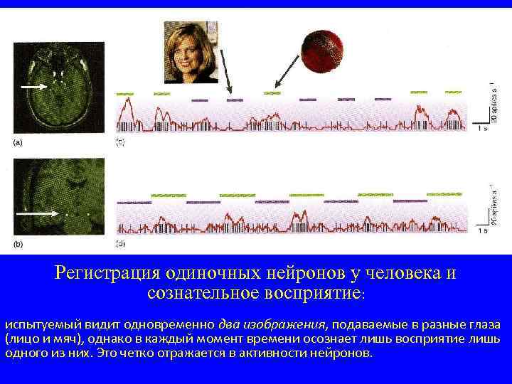 Регистрация одиночных нейронов у человека и сознательное восприятие: испытуемый видит одновременно два изображения, подаваемые