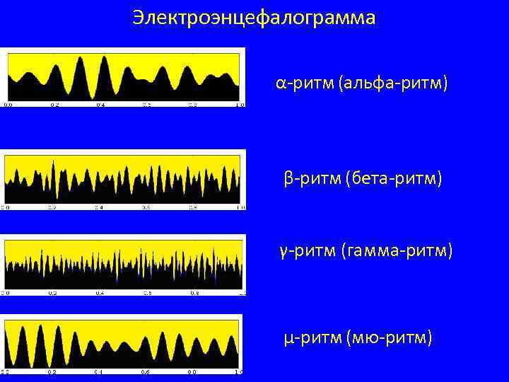 Электроэнцефалограмма α-ритм (альфа-ритм) β-ритм (бета-ритм) γ-ритм (гамма-ритм) μ-ритм (мю-ритм) 