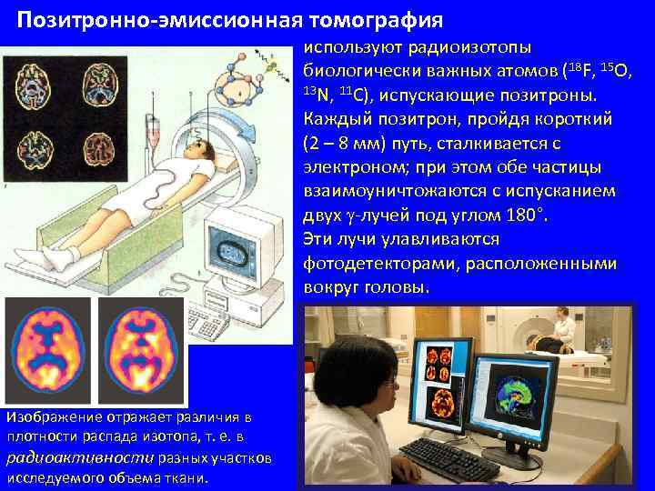 Позитронно-эмиссионная томография используют радиоизотопы биологически важных атомов (18 F, 15 O, 13 N, 11