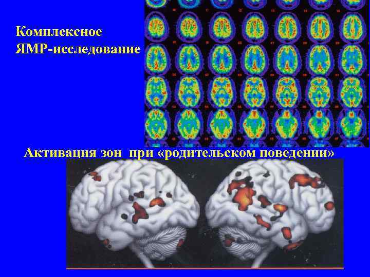 Комплексное ЯМР-исследование Активация зон при «родительском поведении» 