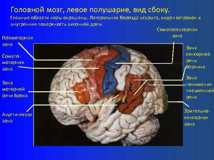 Головной мозг, левое полушарие, вид сбоку. Главные области коры окрашены. Латеральная борозда вскрыта, виден