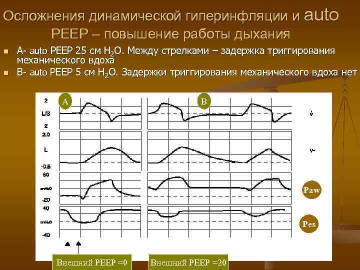 Осложнения динамической гиперинфляции и auto РЕЕР – повышение работы дыхания n n А- auto