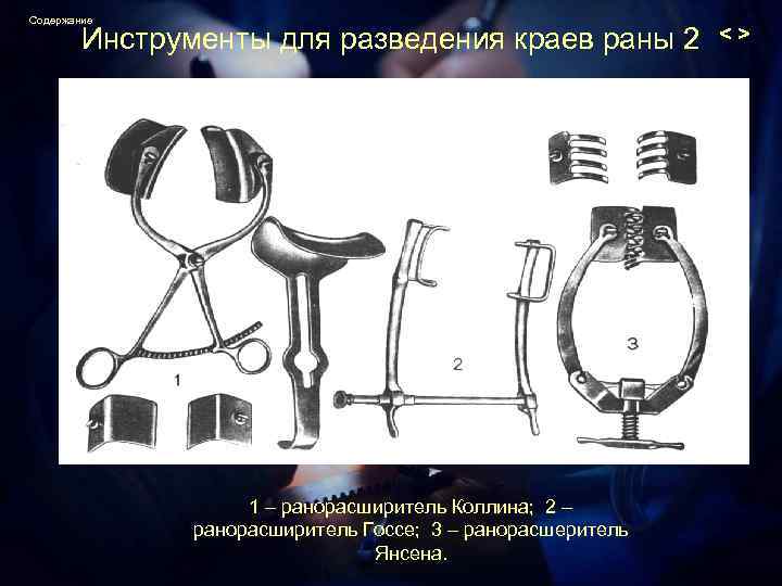 Содержание Инструменты для разведения краев раны 2 1 – ранорасширитель Коллина; 2 – ранорасширитель