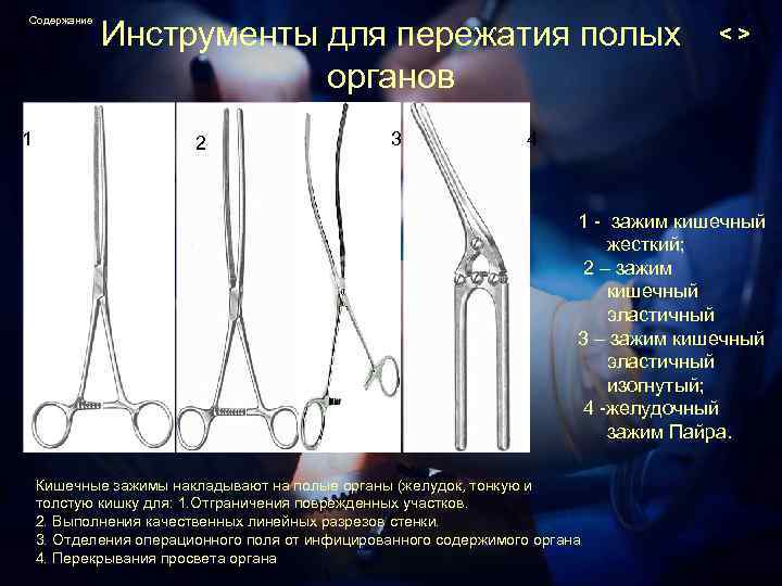 Содержание 1 Инструменты для пережатия полых органов 2 3 <> 4 1 - зажим